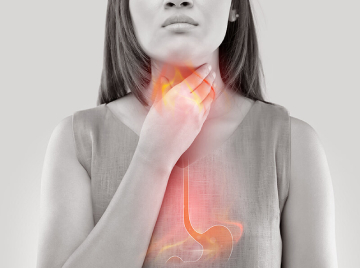 Is There a Difference Between Heartburn, Acid Reflux, and Gastroesophageal Reflux Disease (GERD)?