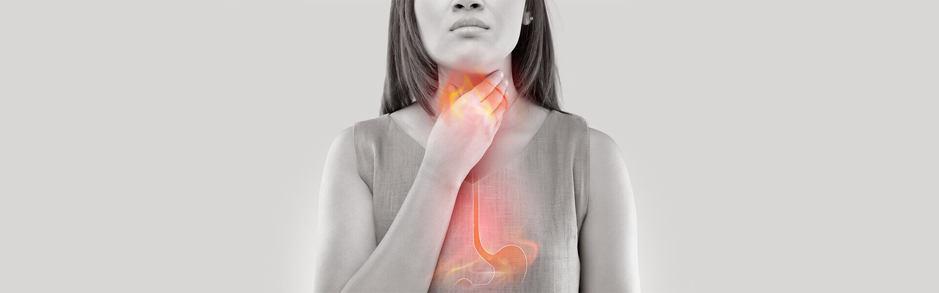 Is There a Difference Between Heartburn, Acid Reflux, and Gastroesophageal Reflux Disease (GERD)?